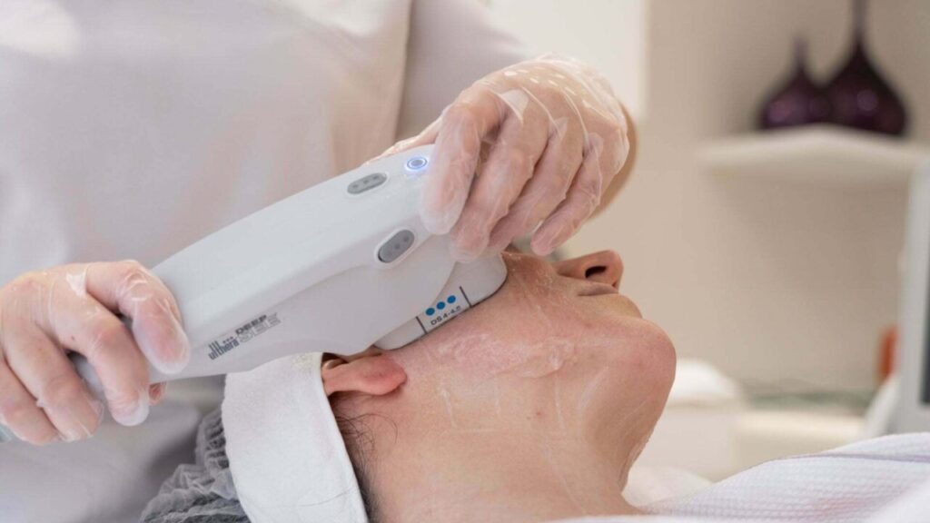Ultherapy для шкіри обличчя