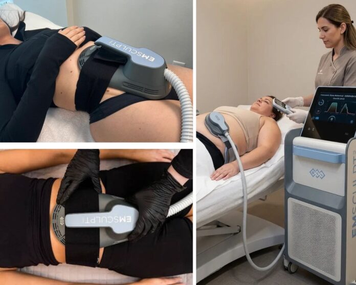 Чи справді Emsculpt зменшує жир