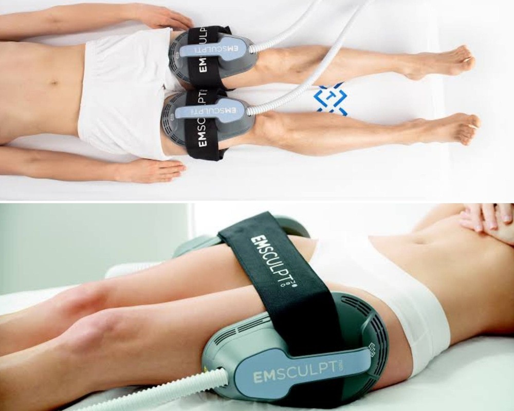 Як працює Emsculpt